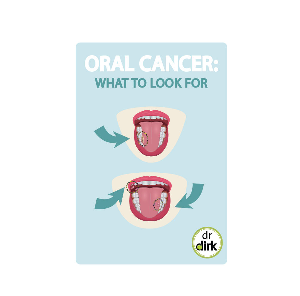 Oral Cancer