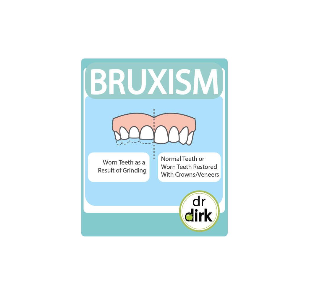 BRUXISM