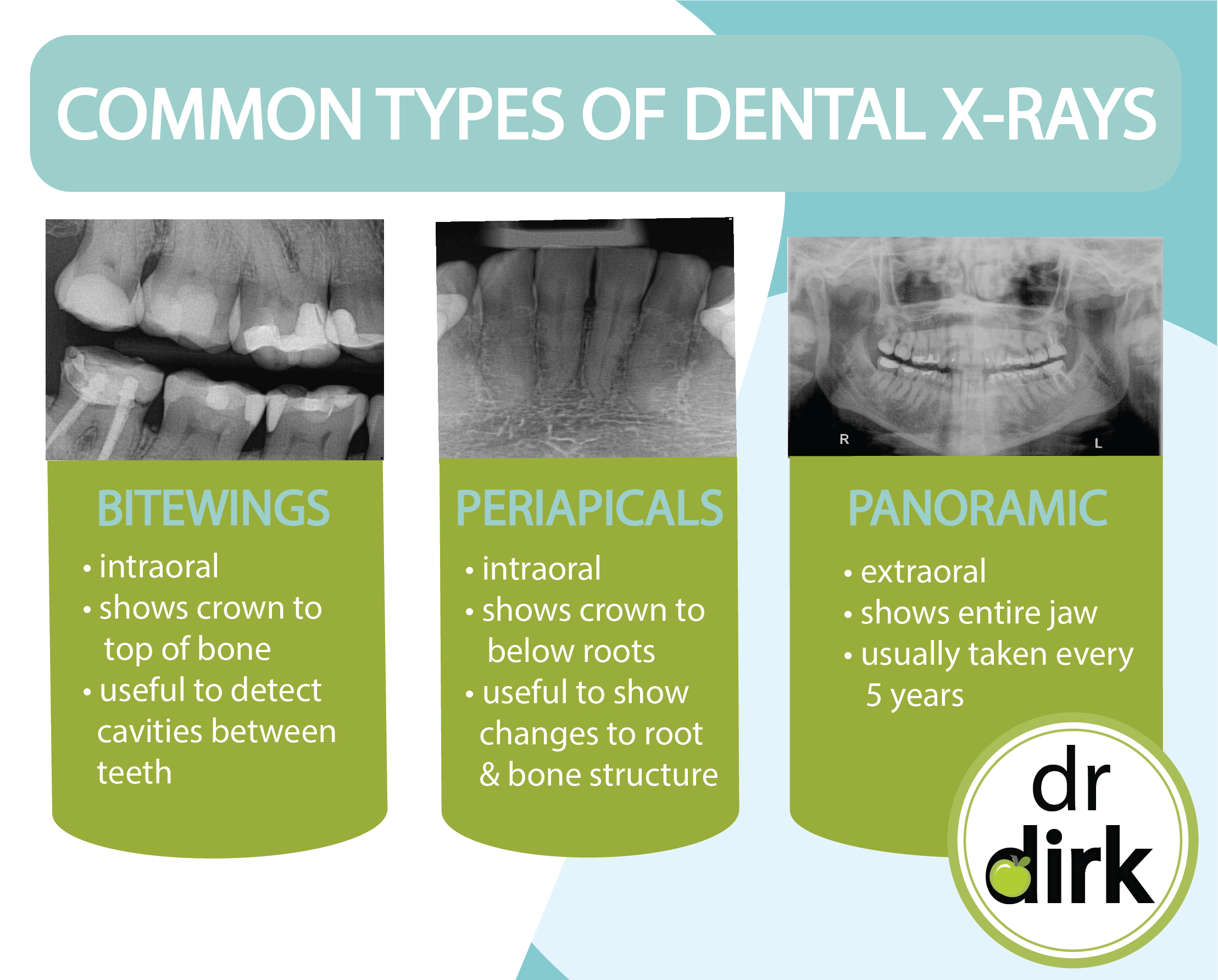dental xrays