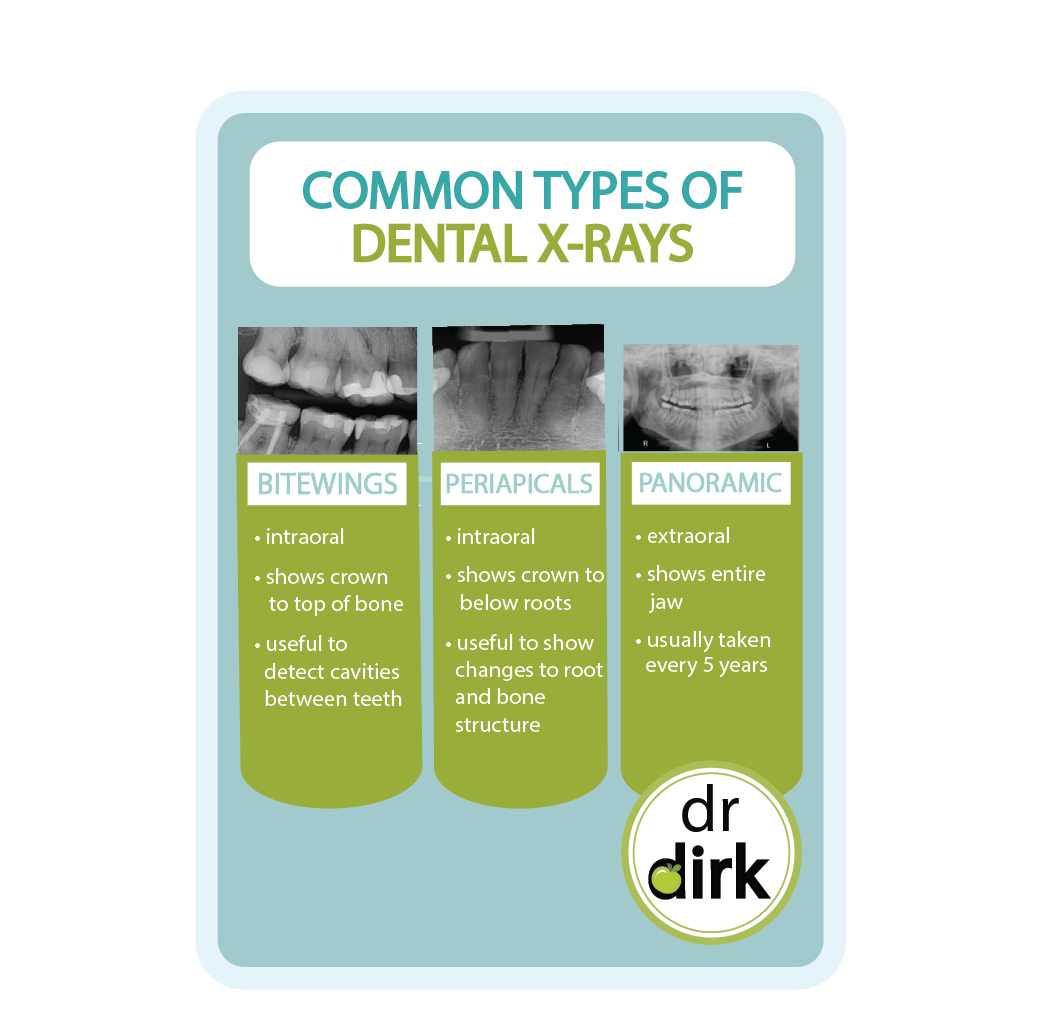 Dental X-Rays
